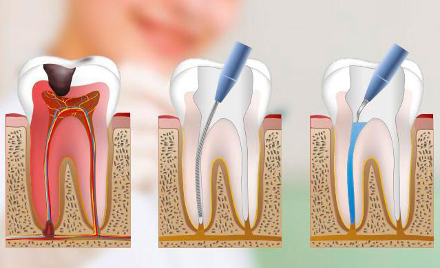 canal dentario 01